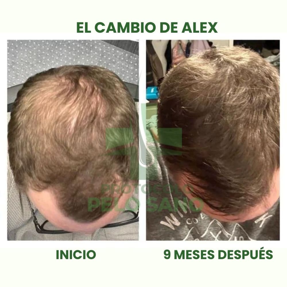 Evolución real: 9 meses después