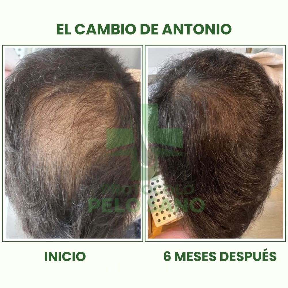 Evolución real: 6 meses después