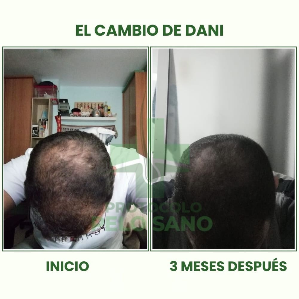 Evolución real: 3 meses después
