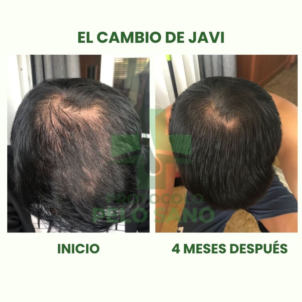 Evolución real: 4 meses después