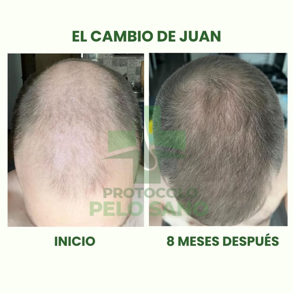Evolución real: 8 meses después
