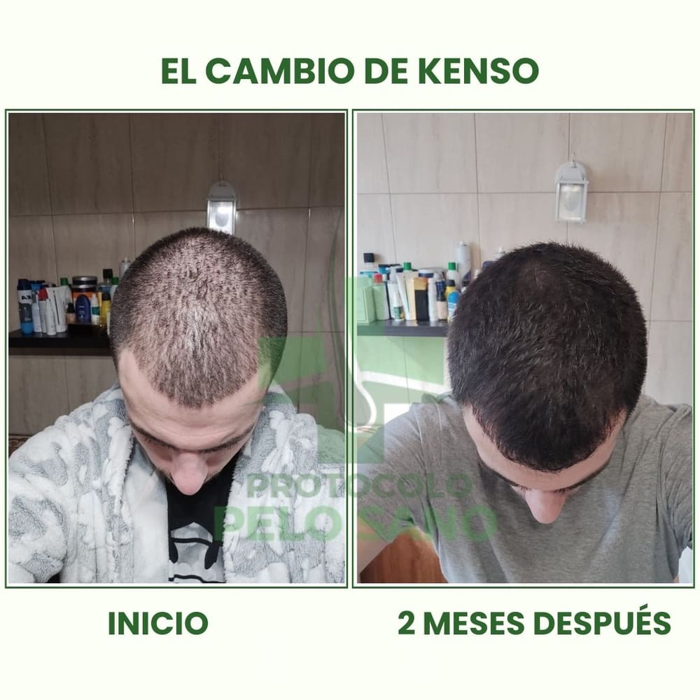 Evolución real: 2 meses después