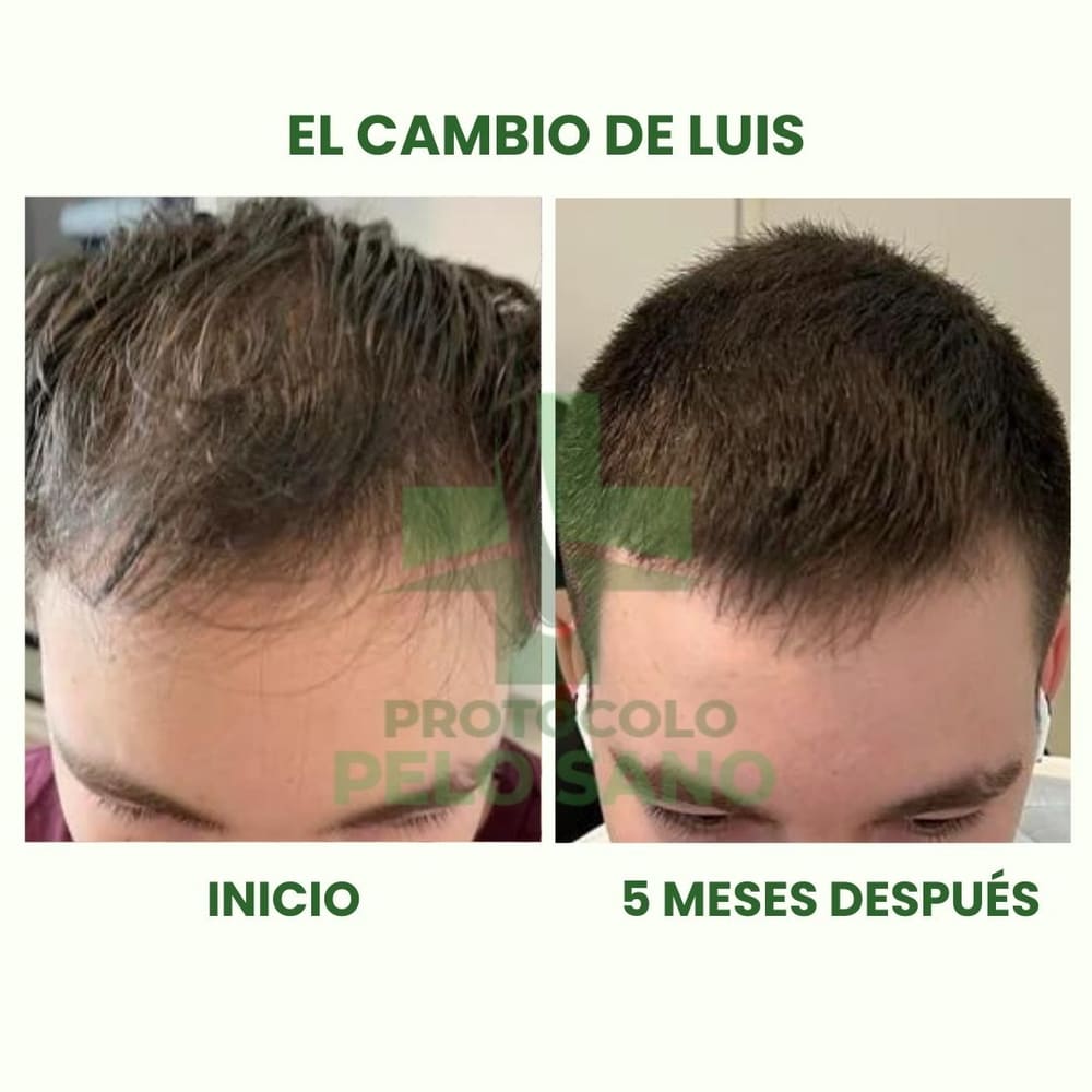 Evolución real: 5 meses después