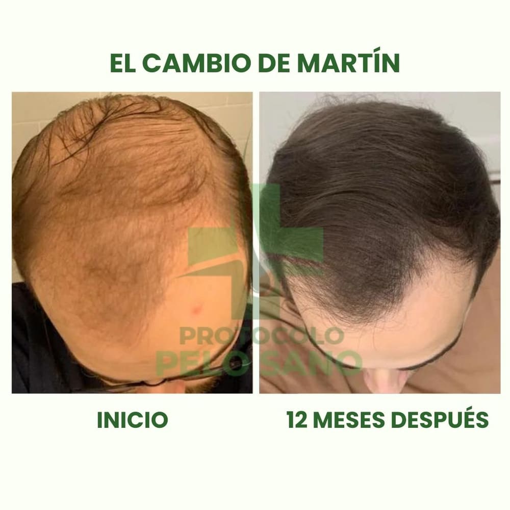 Evolución real: 12 meses después