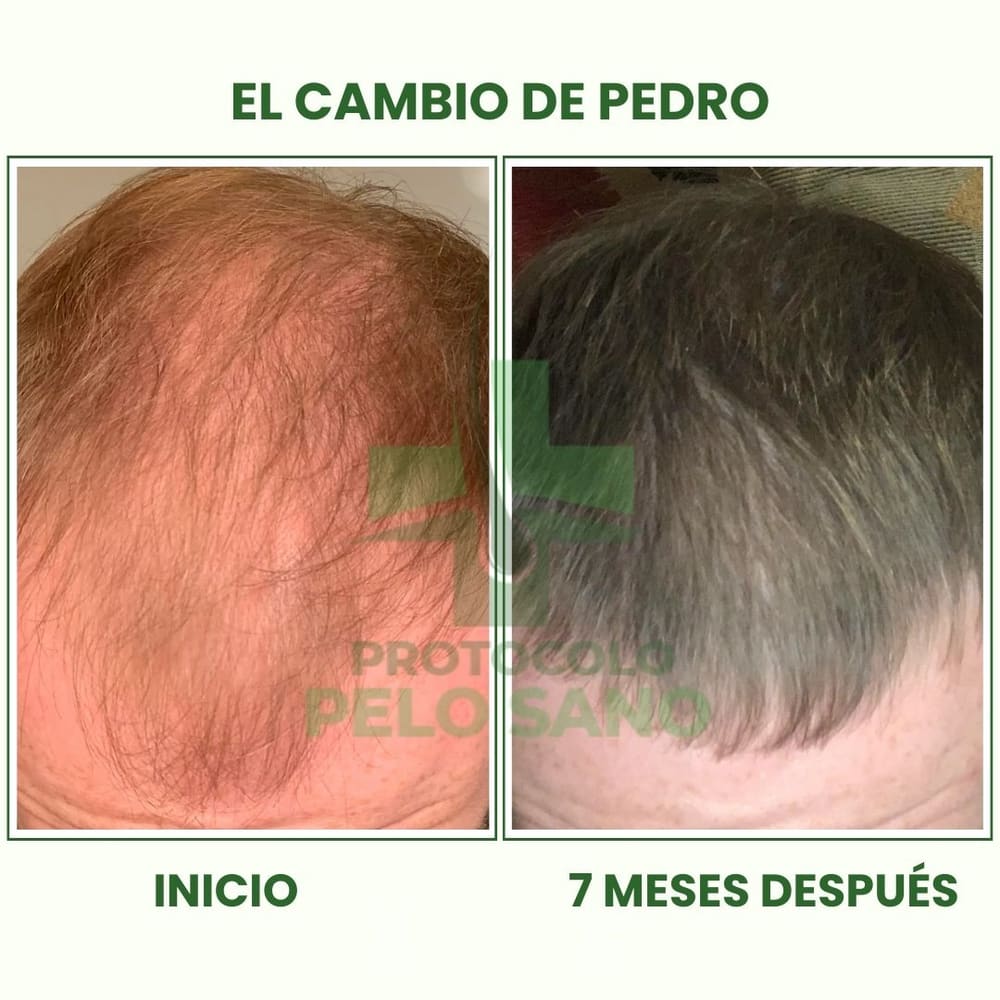 Evolución real: 7 meses después