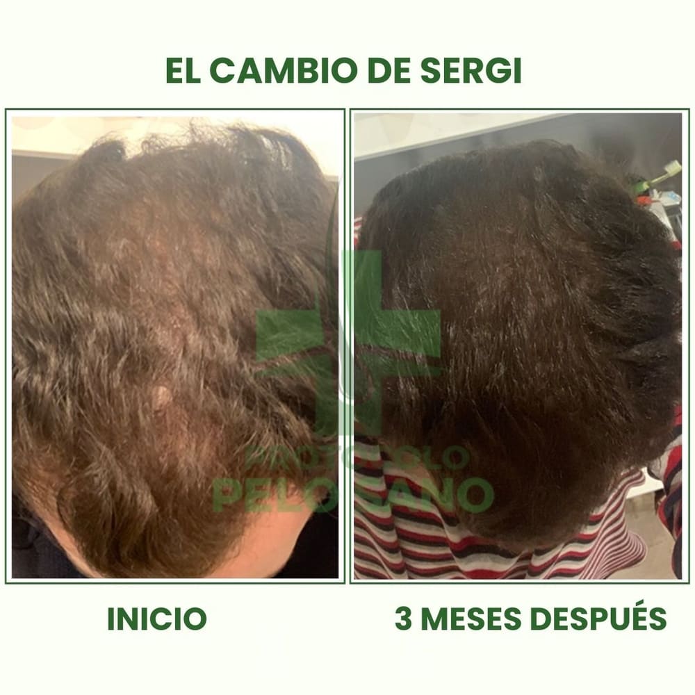 Evolución real: 3 meses después